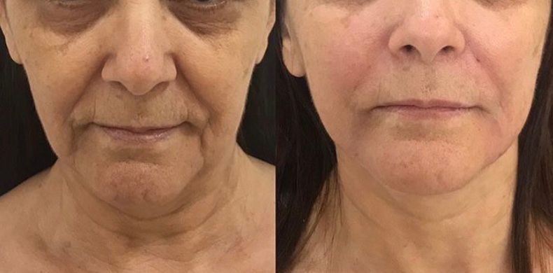 Ana Carolina Paschoalino-15