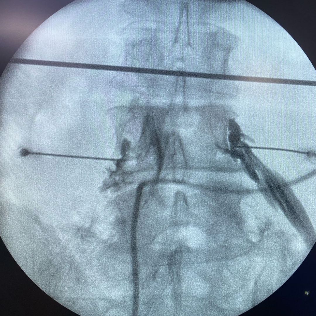 David Tafur Muñoz-2153