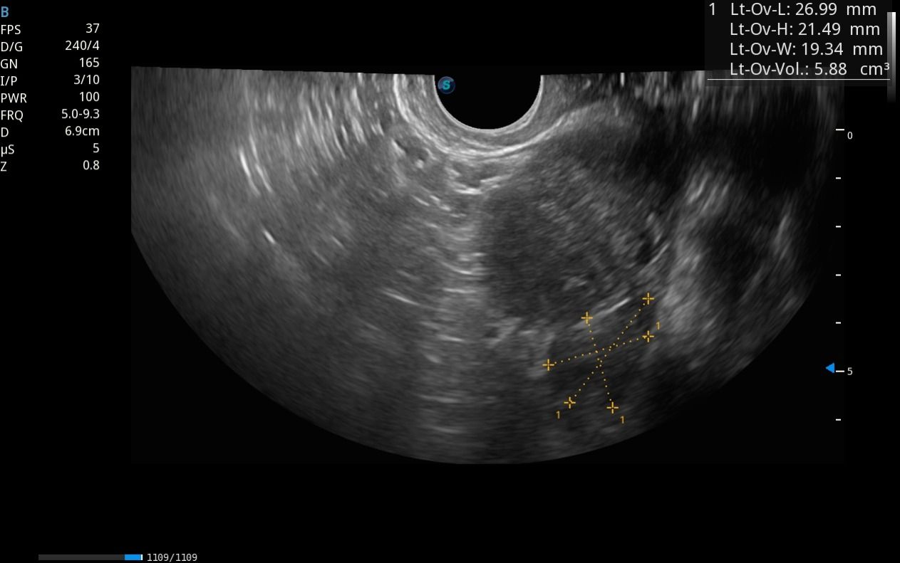 Arisev Maria Figueroa Ramos-3