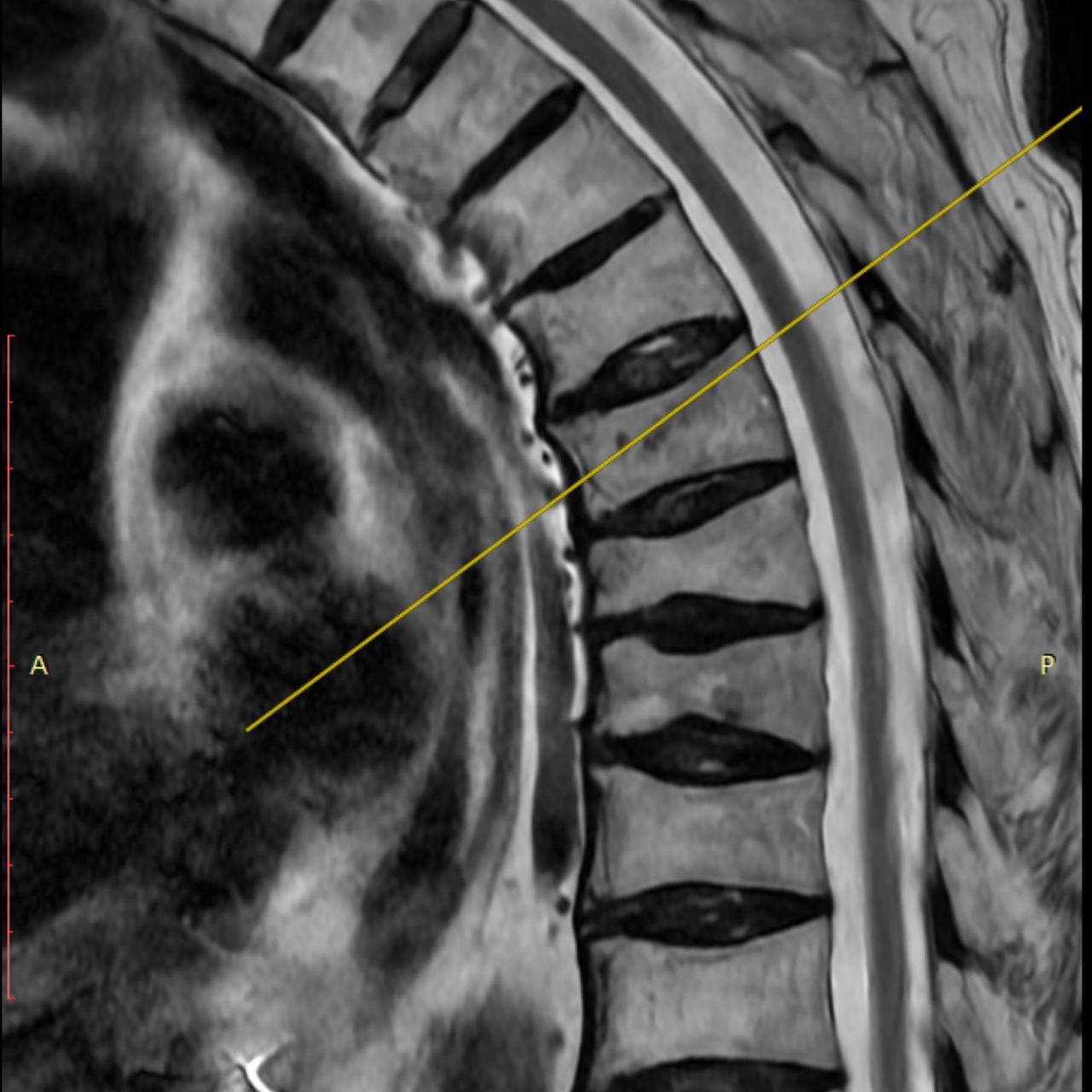 David Tafur Muñoz-1399