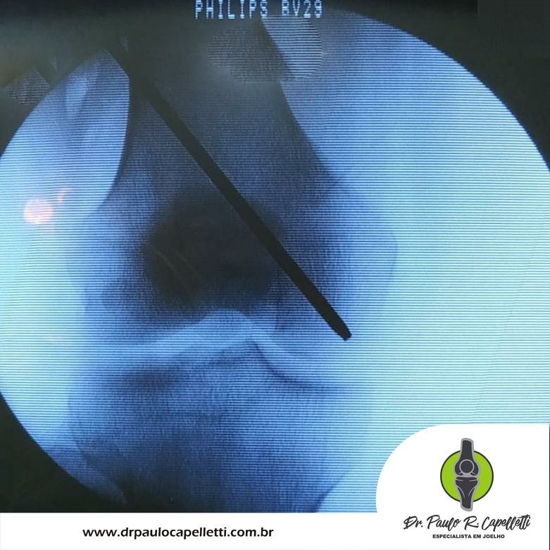 Paulo Roberto Capelletti-82