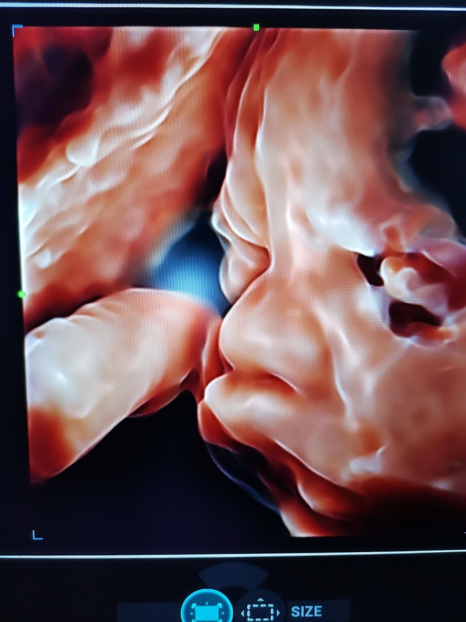 Marcelo Fierro Jarrin-12