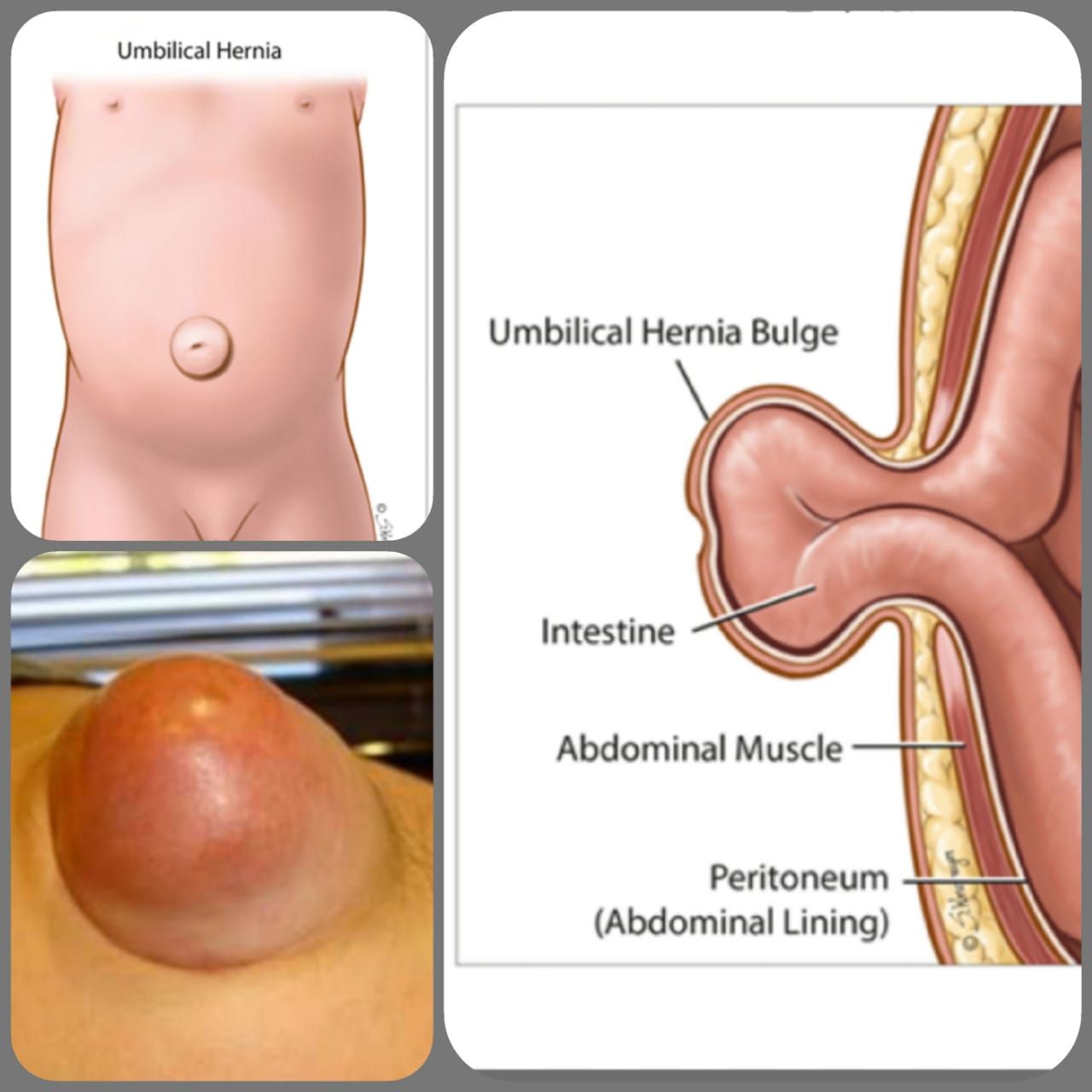 Niele Gonzaga Marques Souza-11