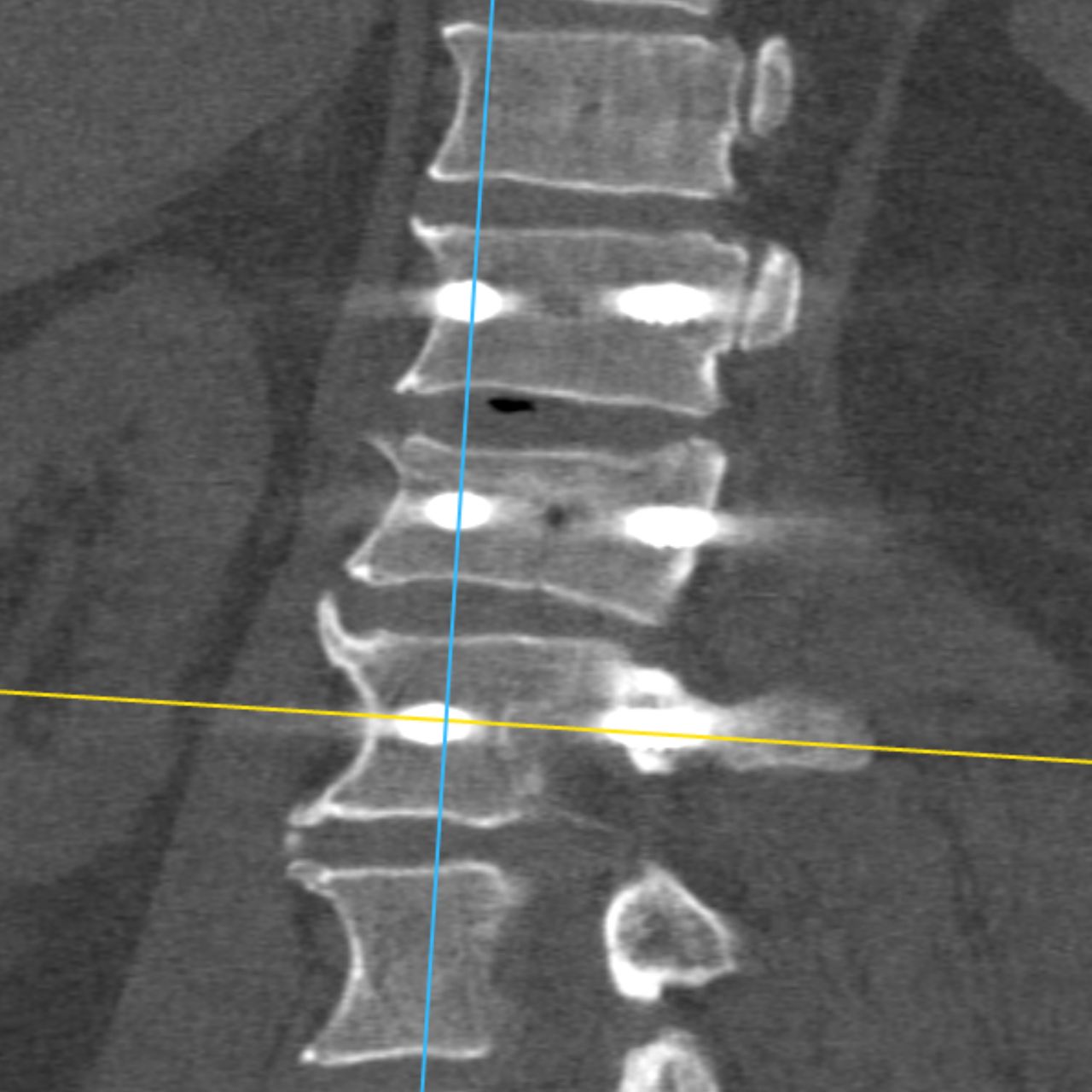 David Tafur Muñoz-1485