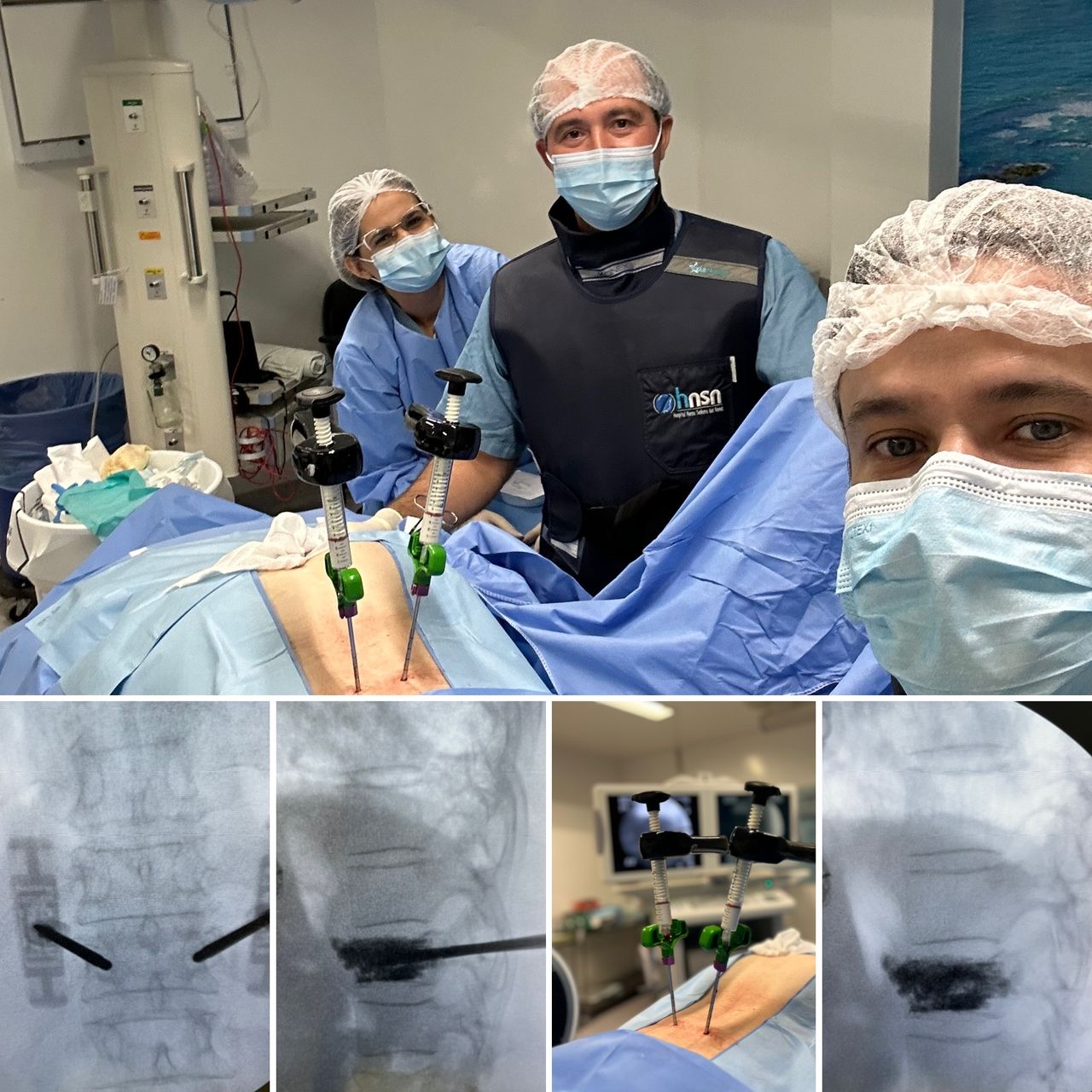 José Lopes Sousa Filho-7