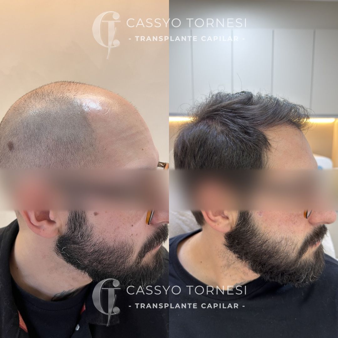 Cassyo Tornesi-30