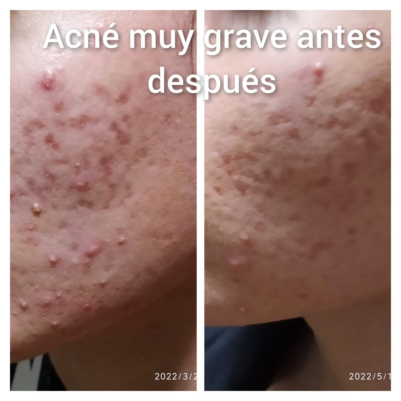 Alejandra Meijide-13