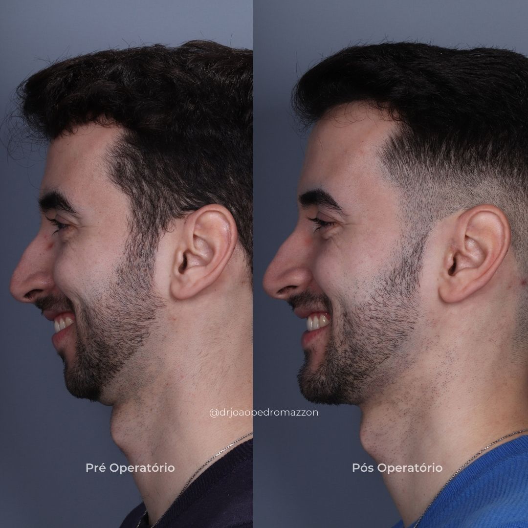 João Pedro Paulino Mazzon-71