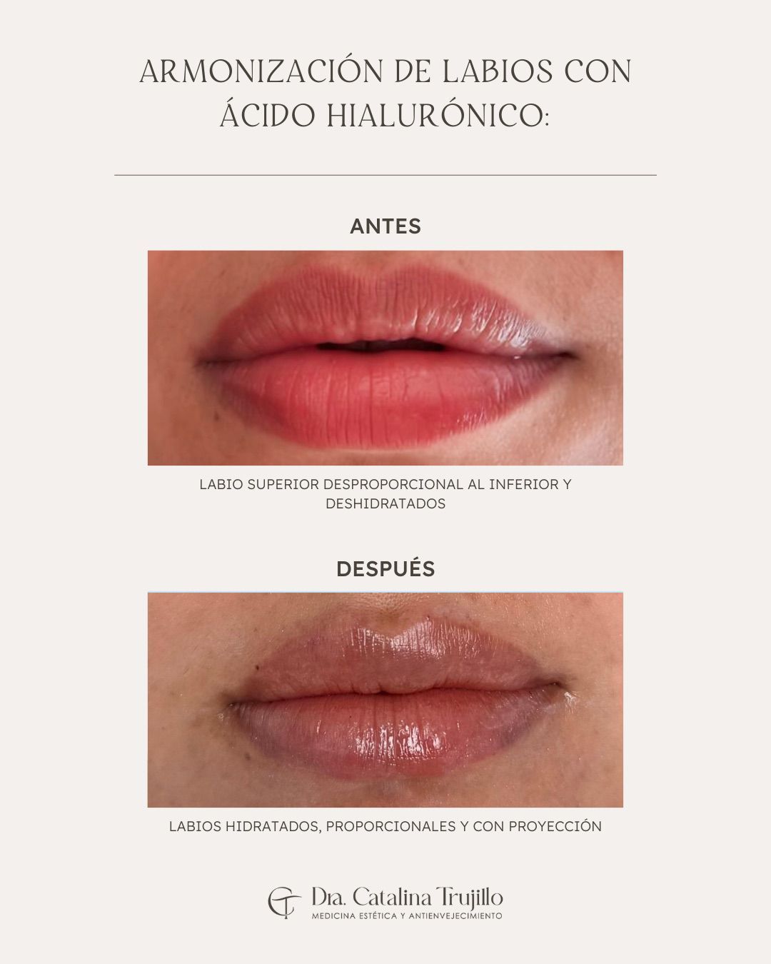 Catalina Trujillo -13