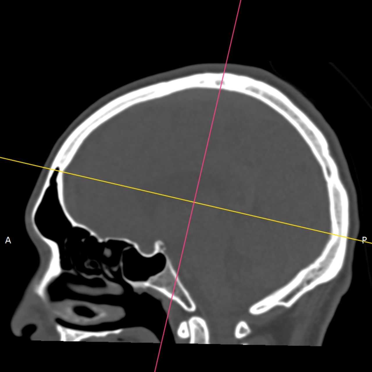 David Tafur Muñoz-2199