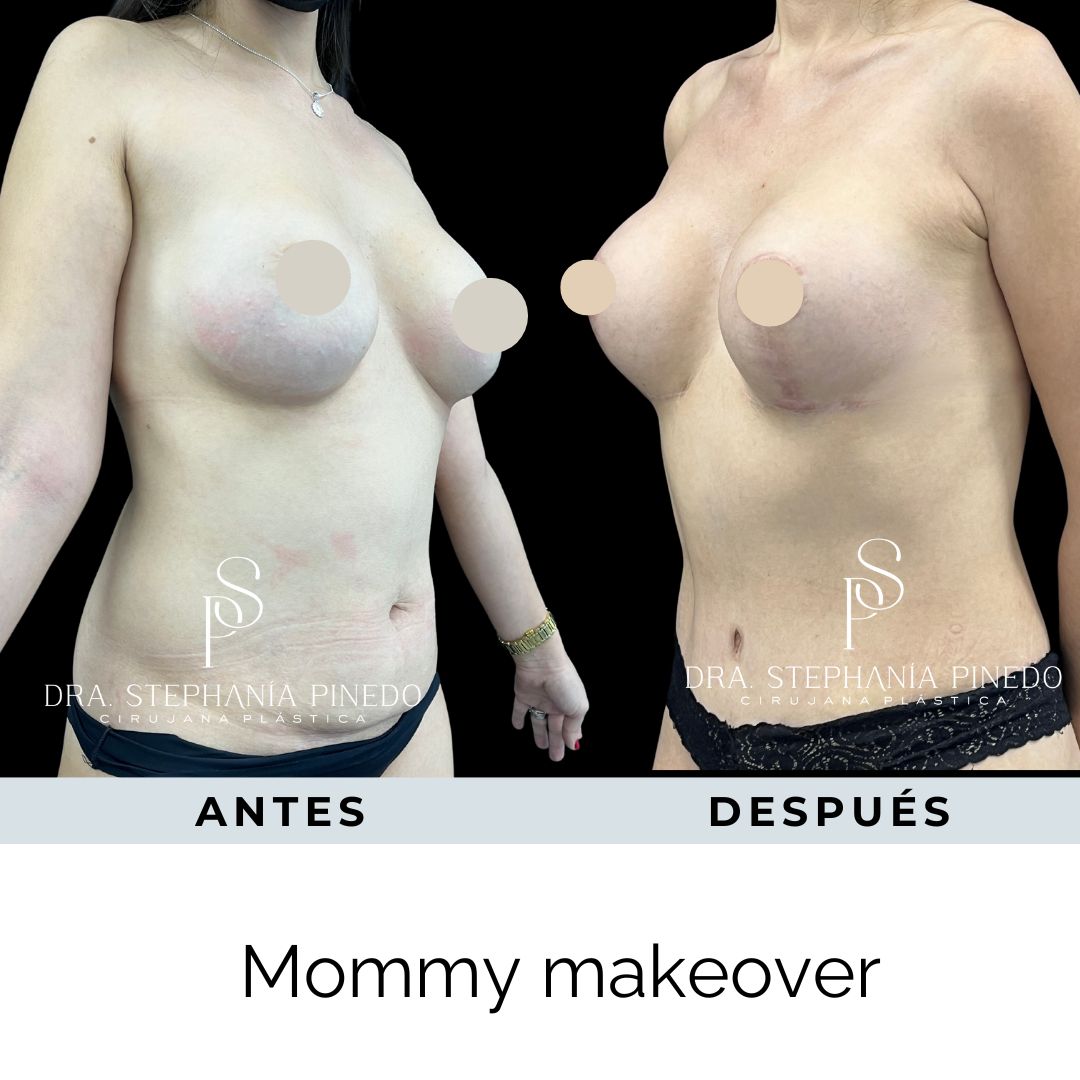 Stephanía Pinedo García-20