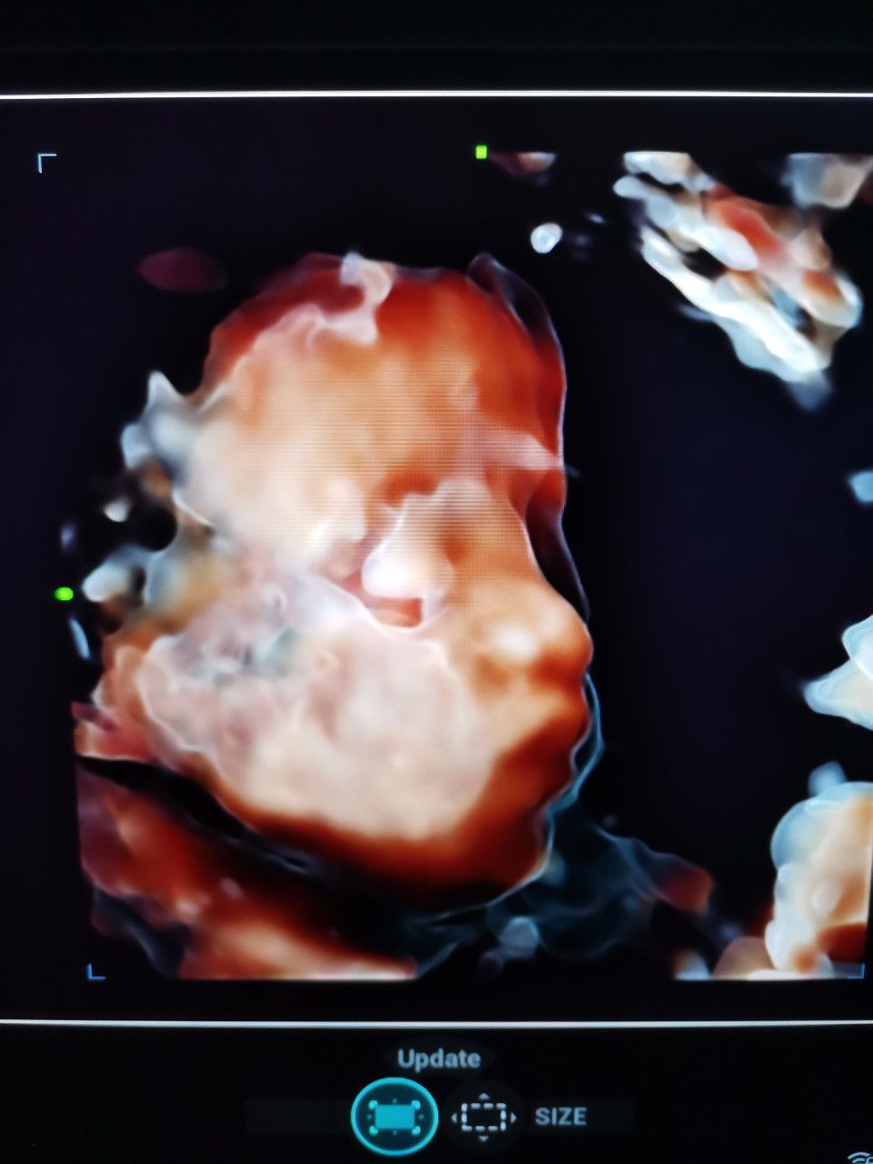 Marcelo Fierro Jarrin-15