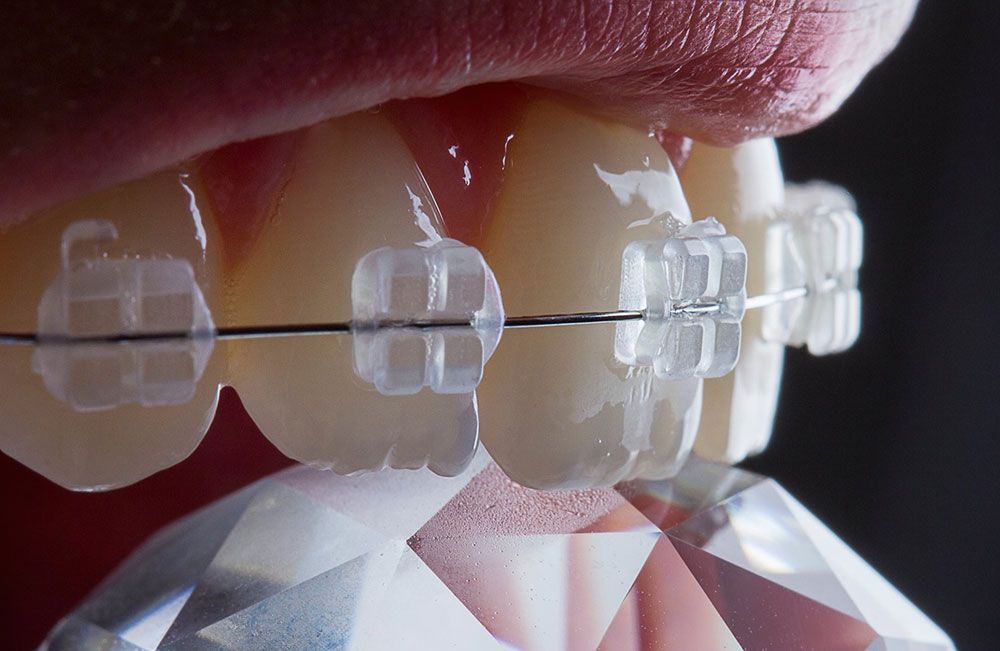 Juliana Pelegrini-15