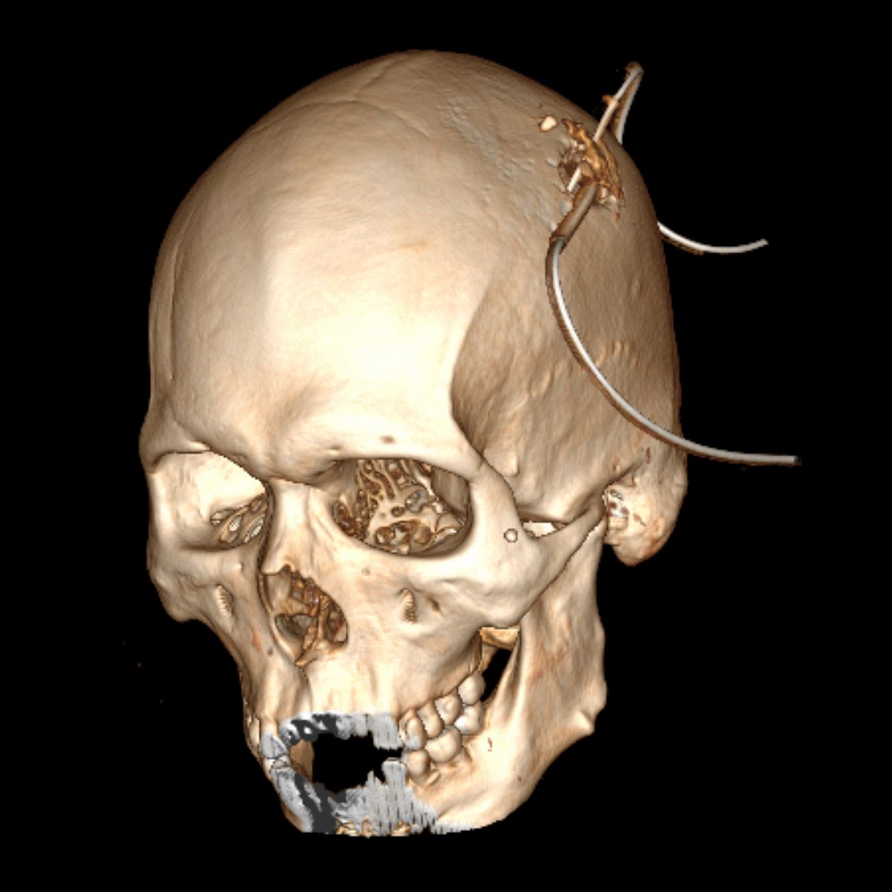 David Tafur Muñoz-2480