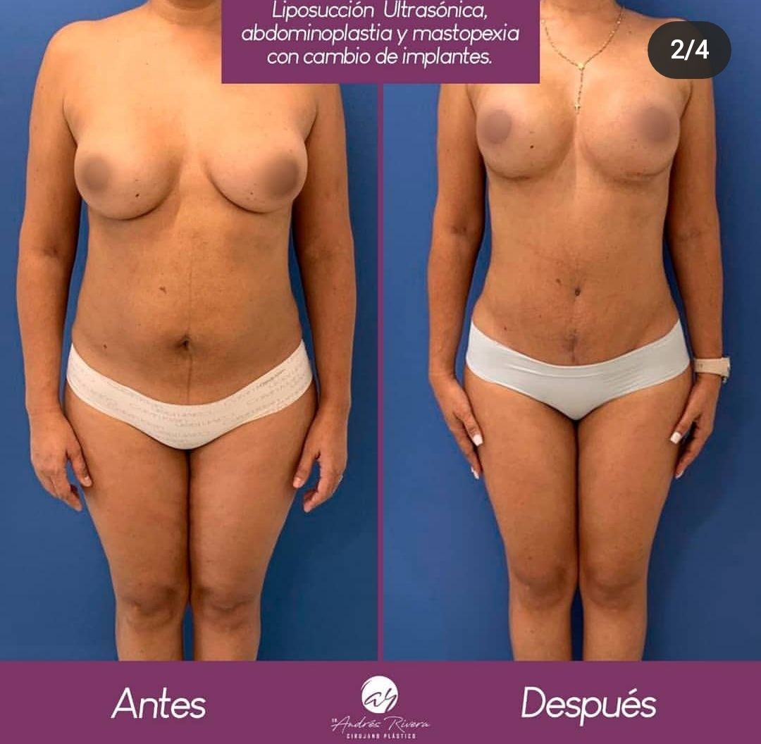 Andrés Rivera López-7