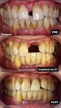 Pablo B. Azcárate-13