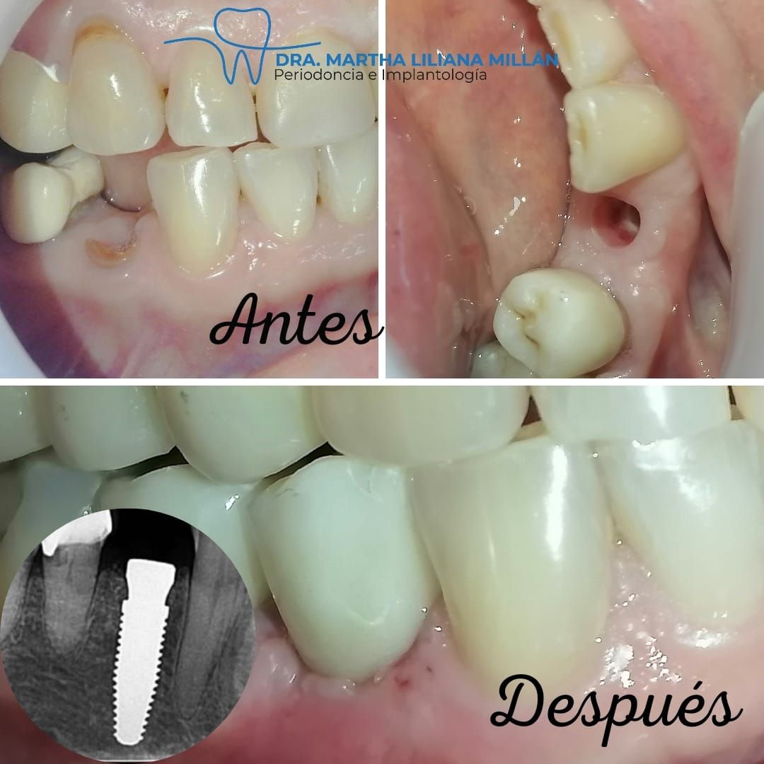 Martha Liliana Millan Diaz-25