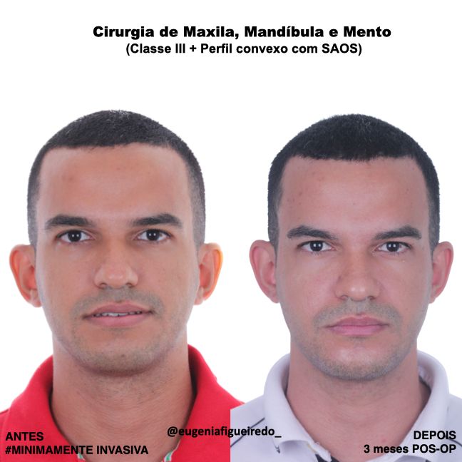 Eugênia Figueiredo-24