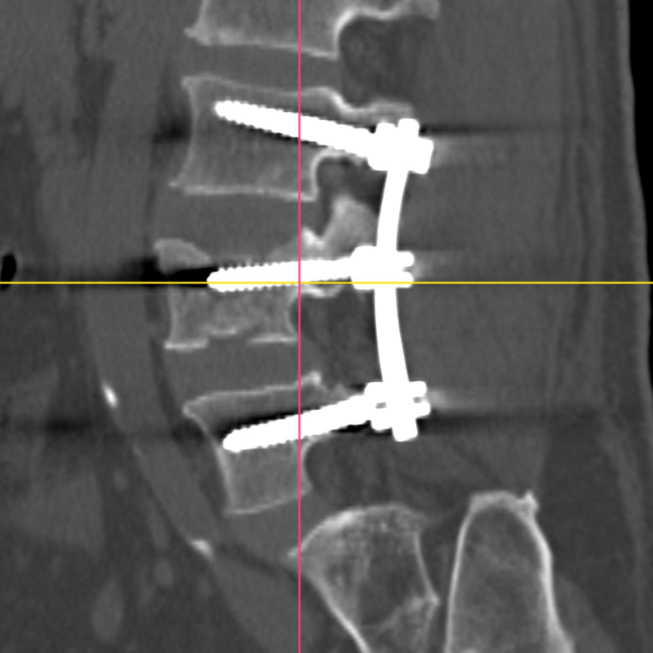 David Tafur Muñoz-1972