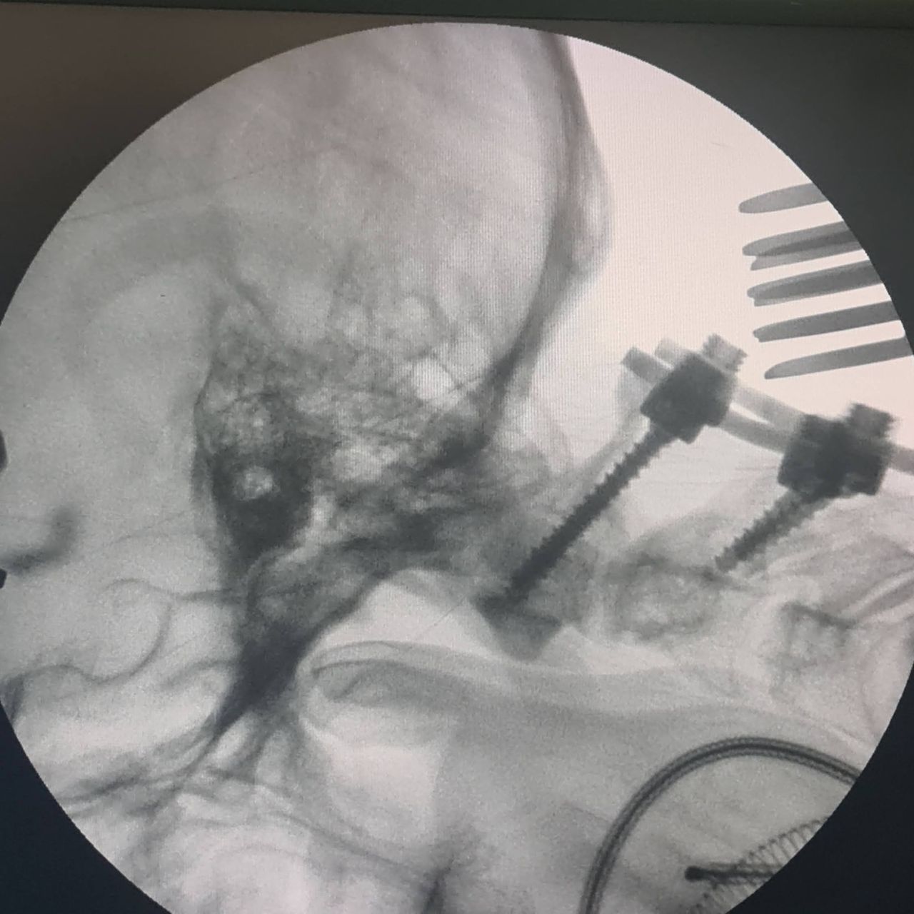 David Tafur Muñoz-1316