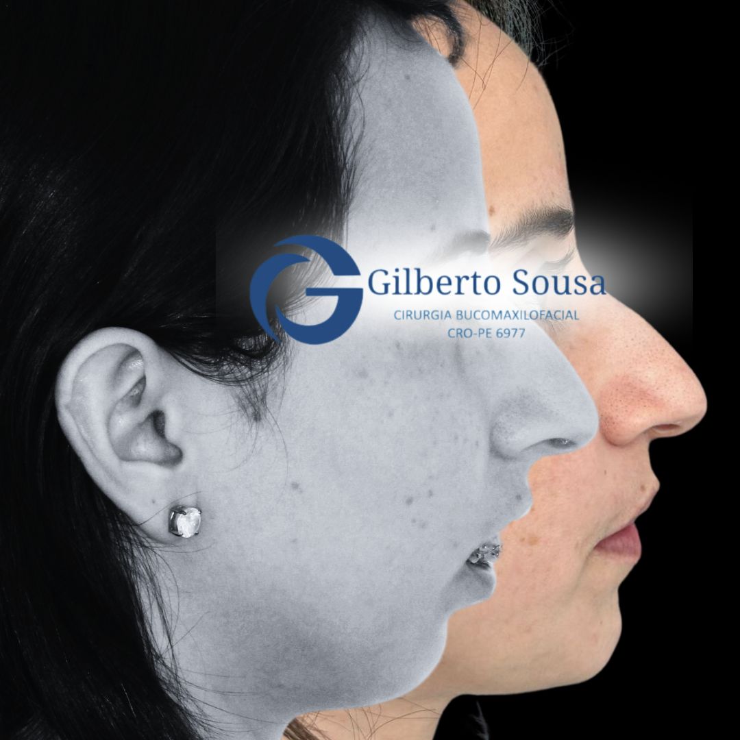 Gilberto Sousa-1