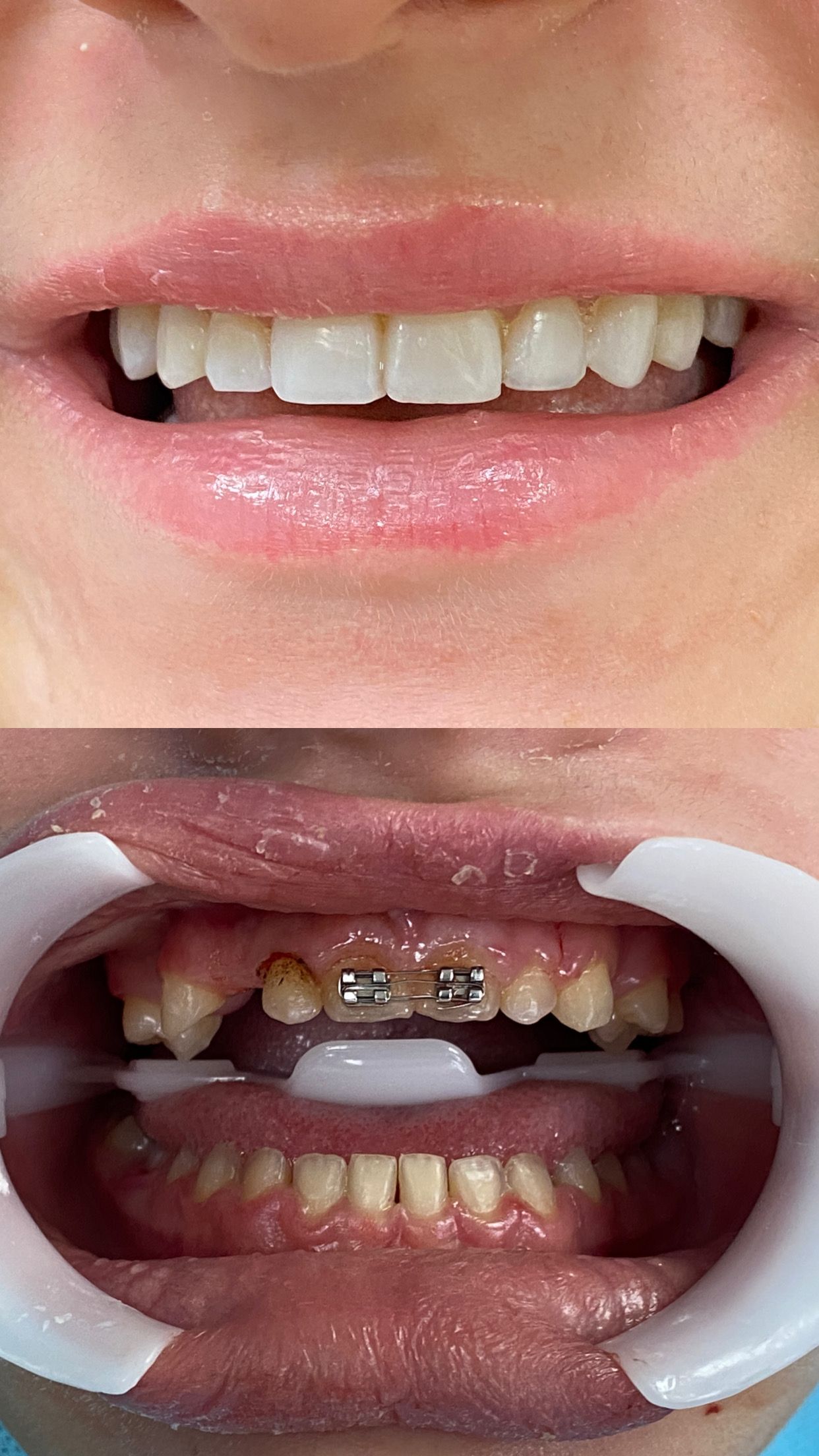 Saint Clair Barbosa Netto-8