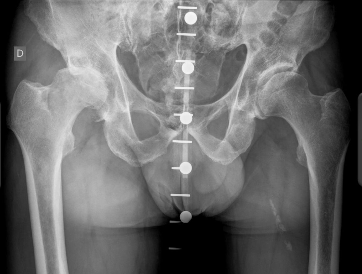 Marcus Vinicius Crestani-5