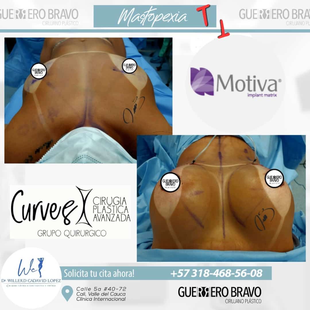 Camilo Guerrero Bravo-36