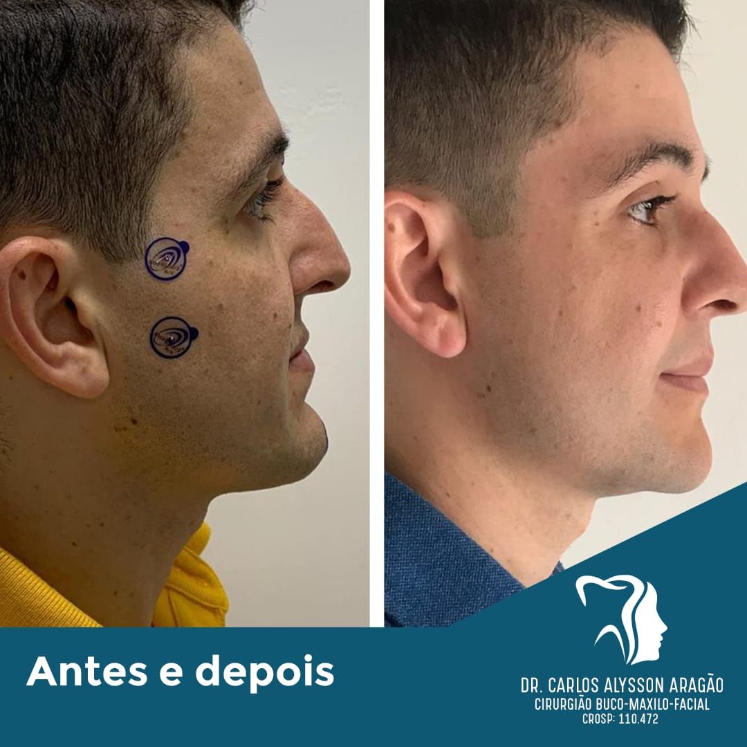 Carlos Alysson Aragão-19