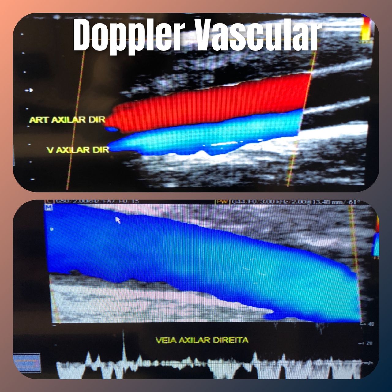 Luiz Carlos Furtat Jr-7