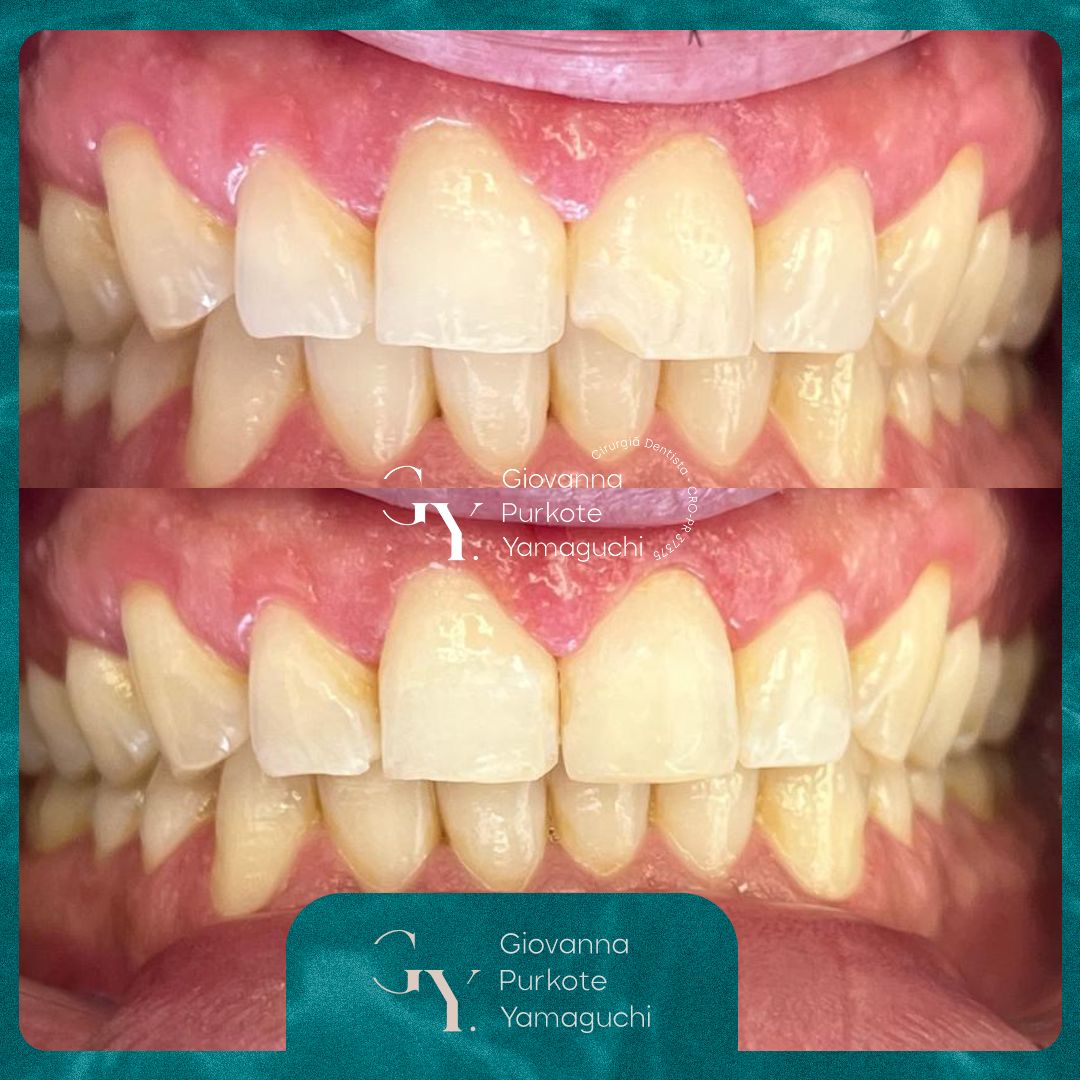 Giovanna Purkote Yamaguchi-2