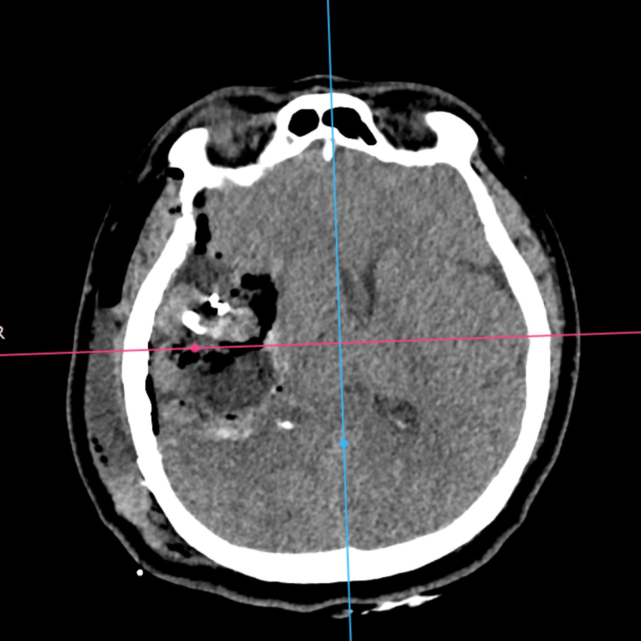 David Tafur Muñoz-1878