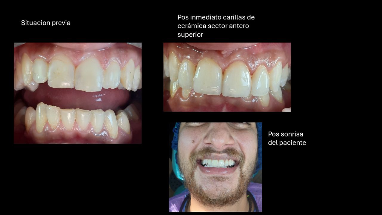 Sebastián Vicente-0