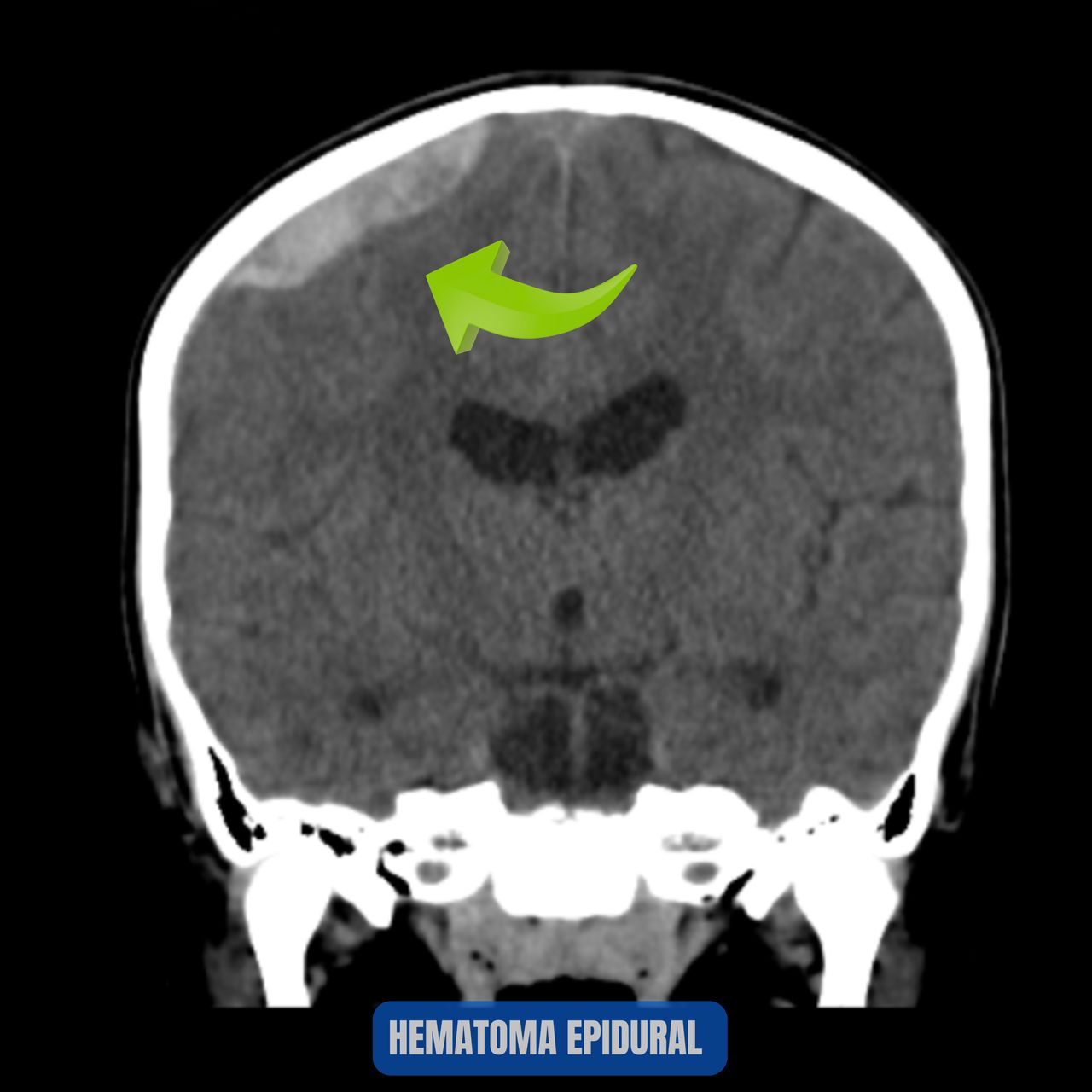 David Tafur Muñoz-2057