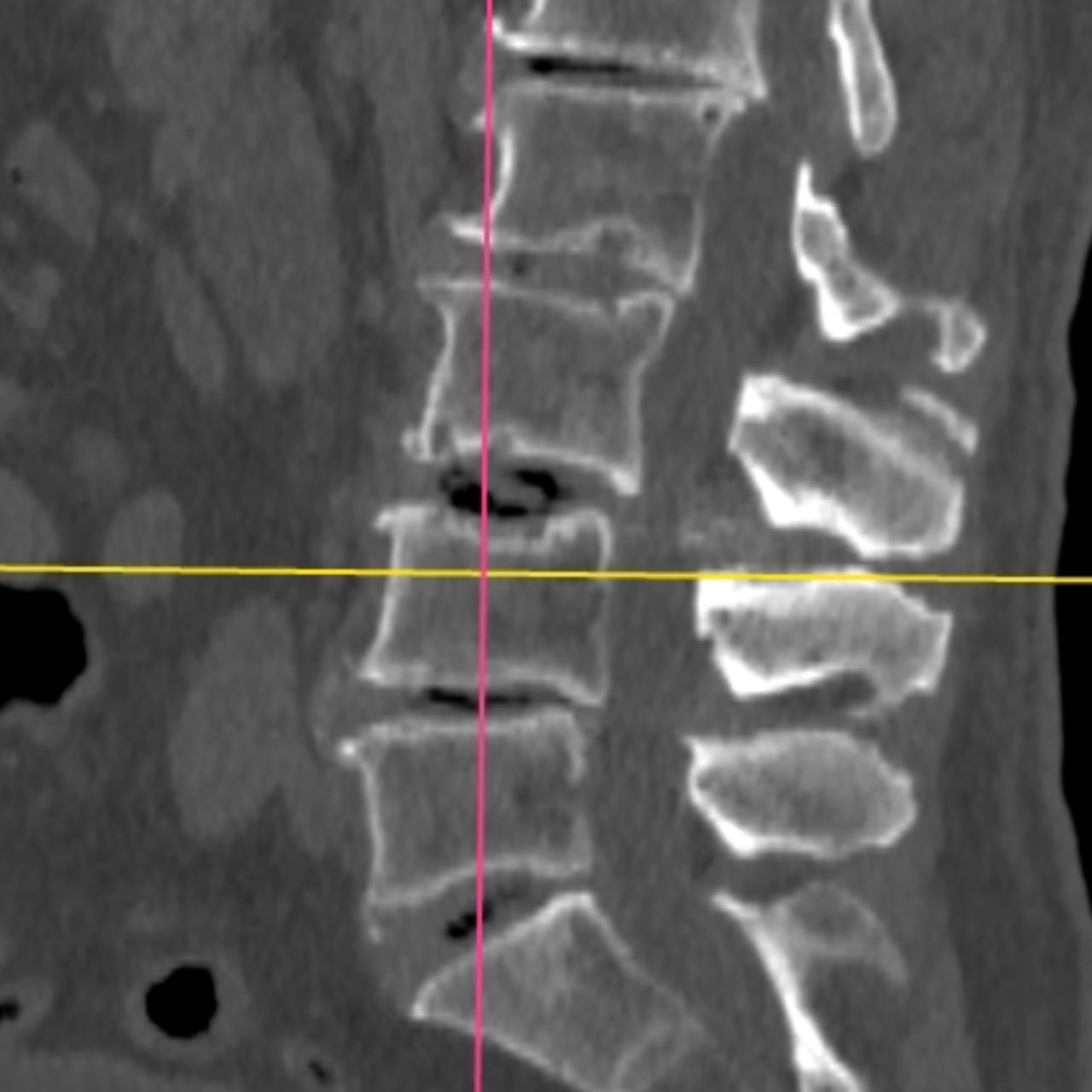David Tafur Muñoz-1687