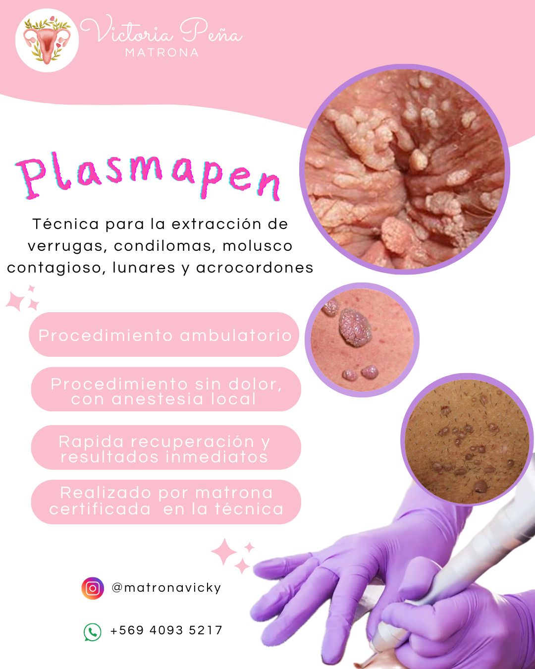 Victoria Peña Zamorano-6