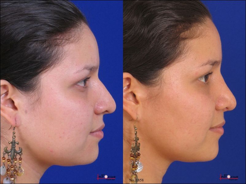 Jorge A Holguin Ruiz-24