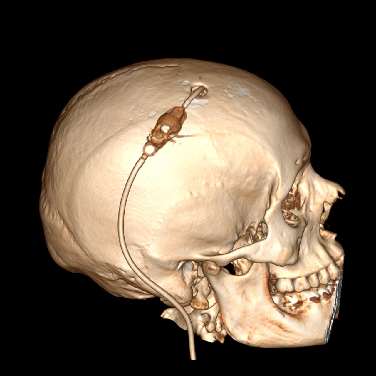 David Tafur Muñoz-2399