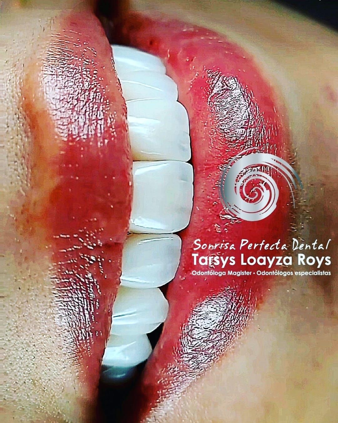 Tarsys Loayza-22