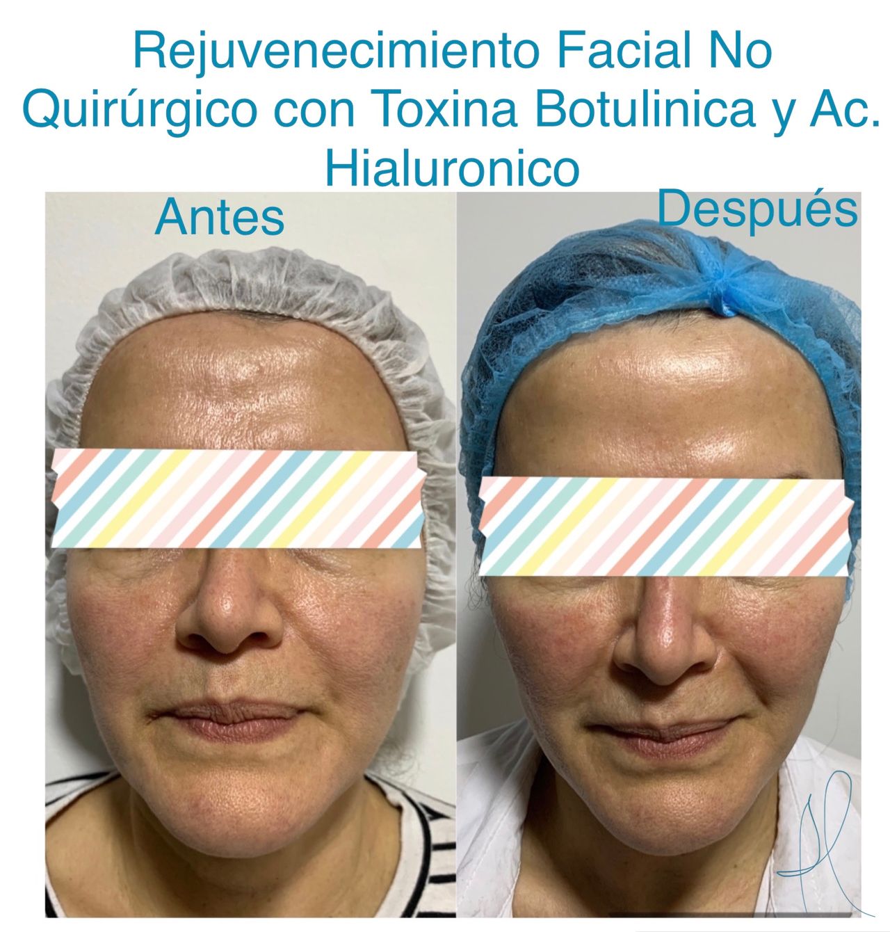 Maria Gisela Angel Losada-17