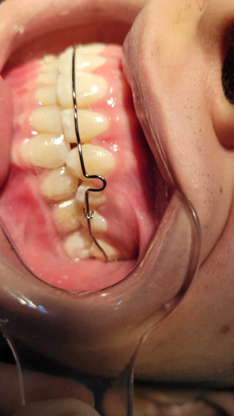 Tarianne Cristina Alves Aguiar-4