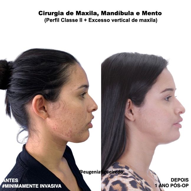 Eugênia Figueiredo-34