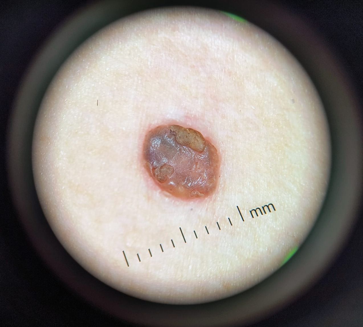 Marcos Ortiz Perez-15