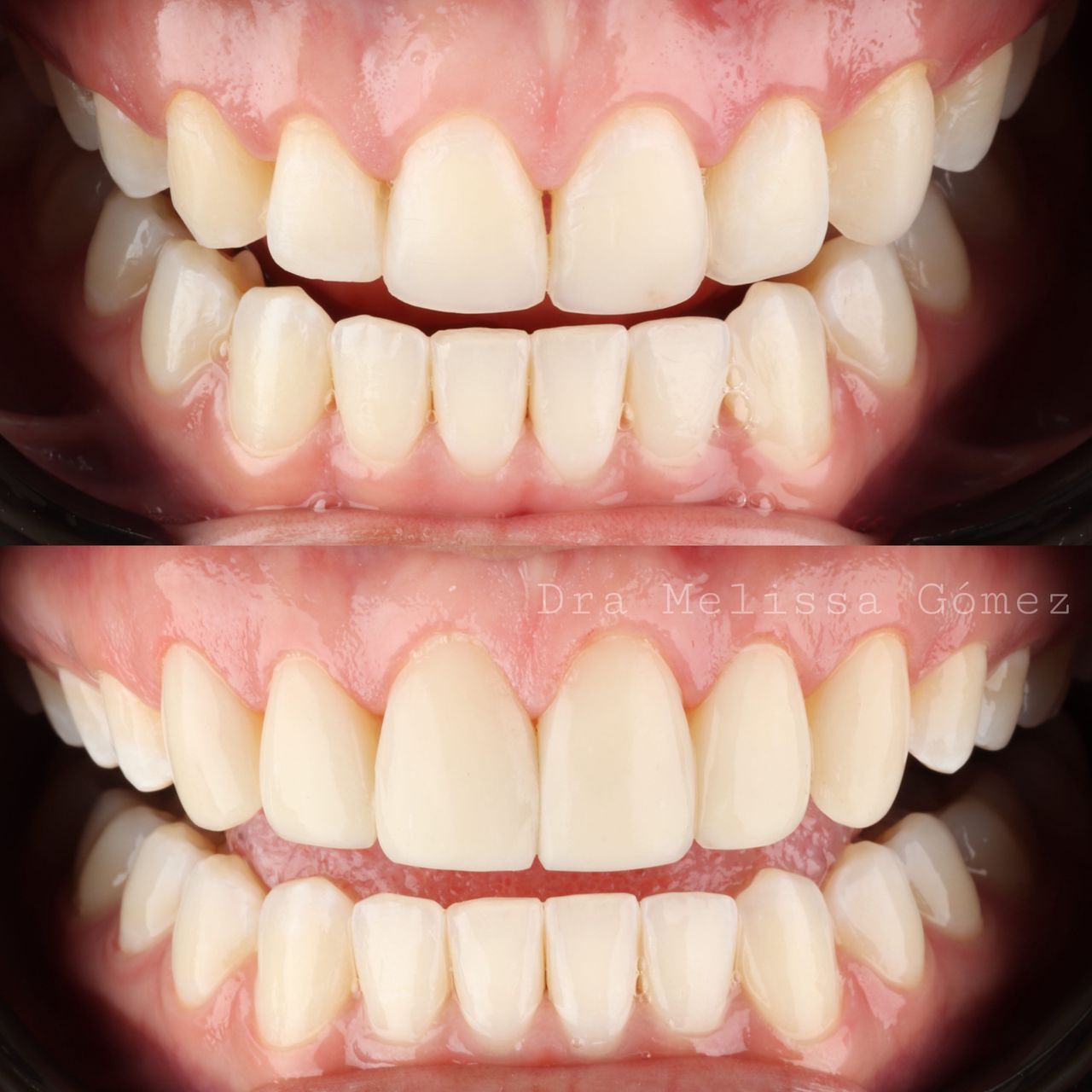 Melissa Gómez Arango-8