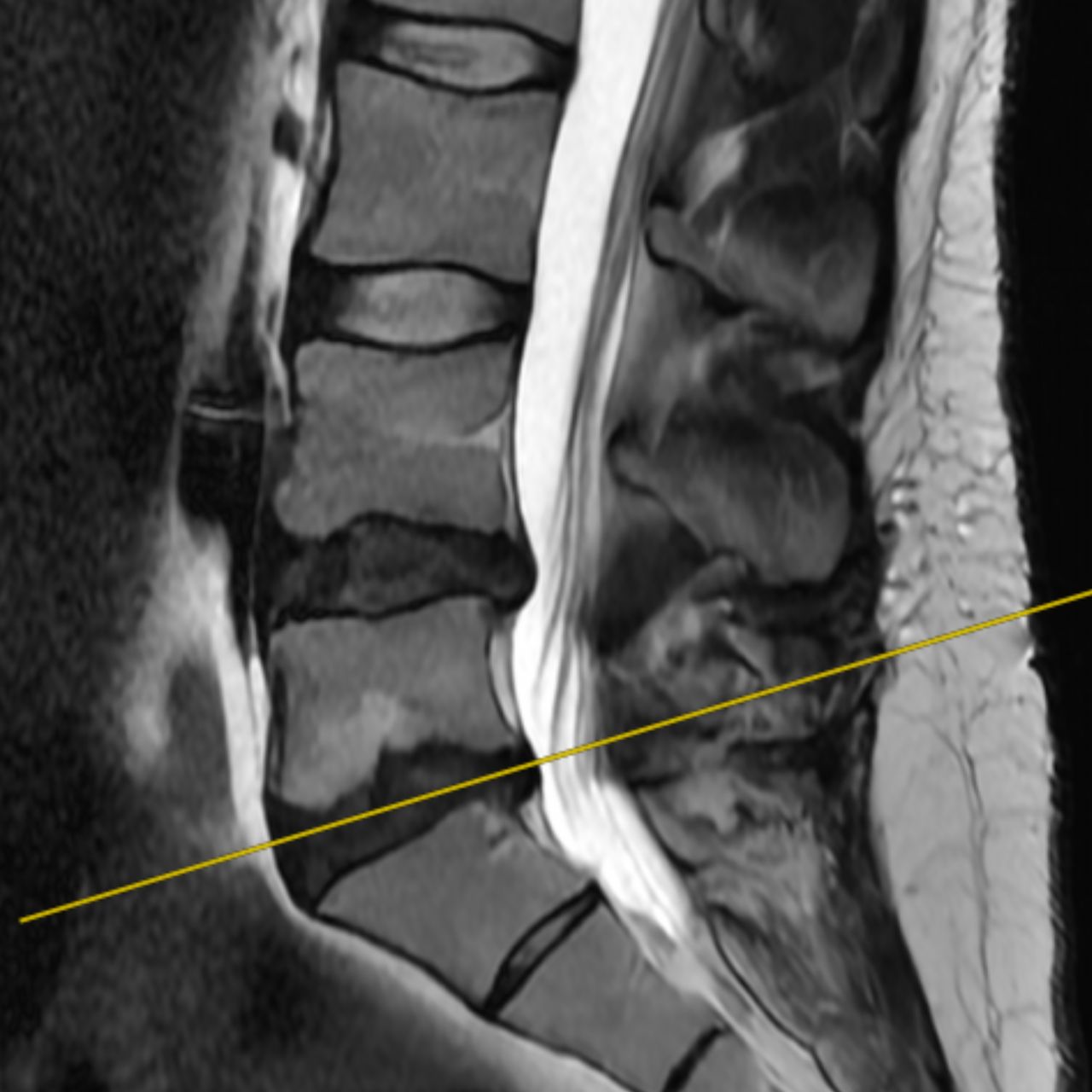 David Tafur Muñoz-1494