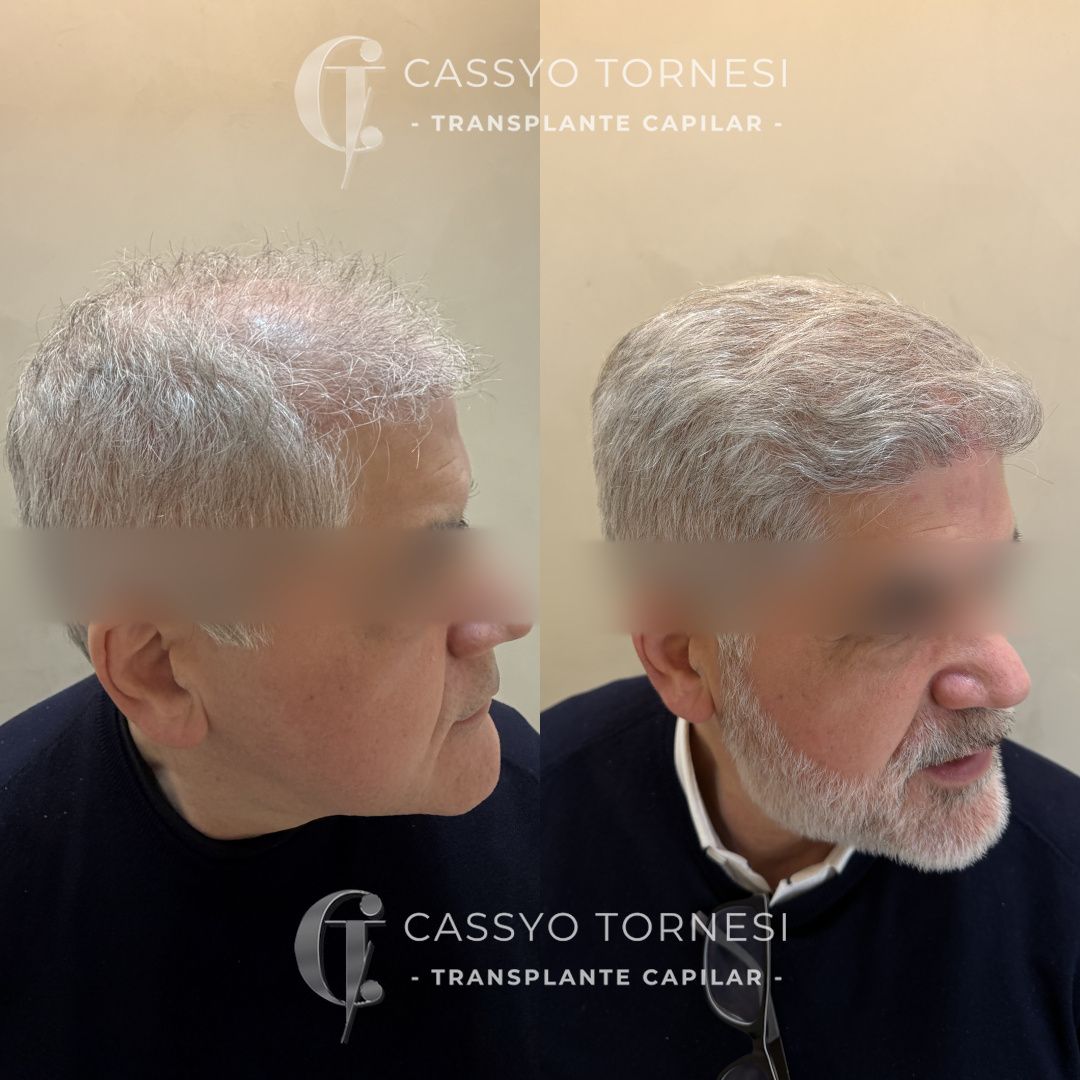 Cassyo Tornesi-28