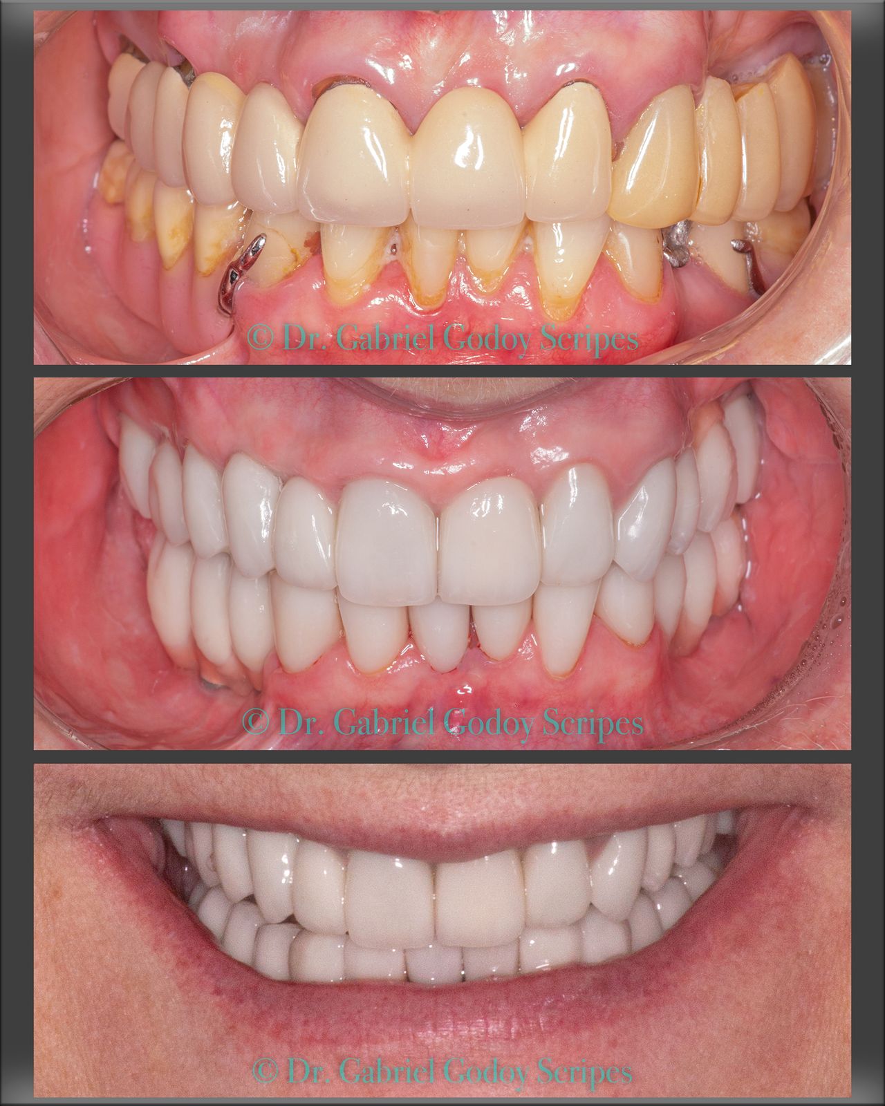 Gabriel Godoy Scripes-87