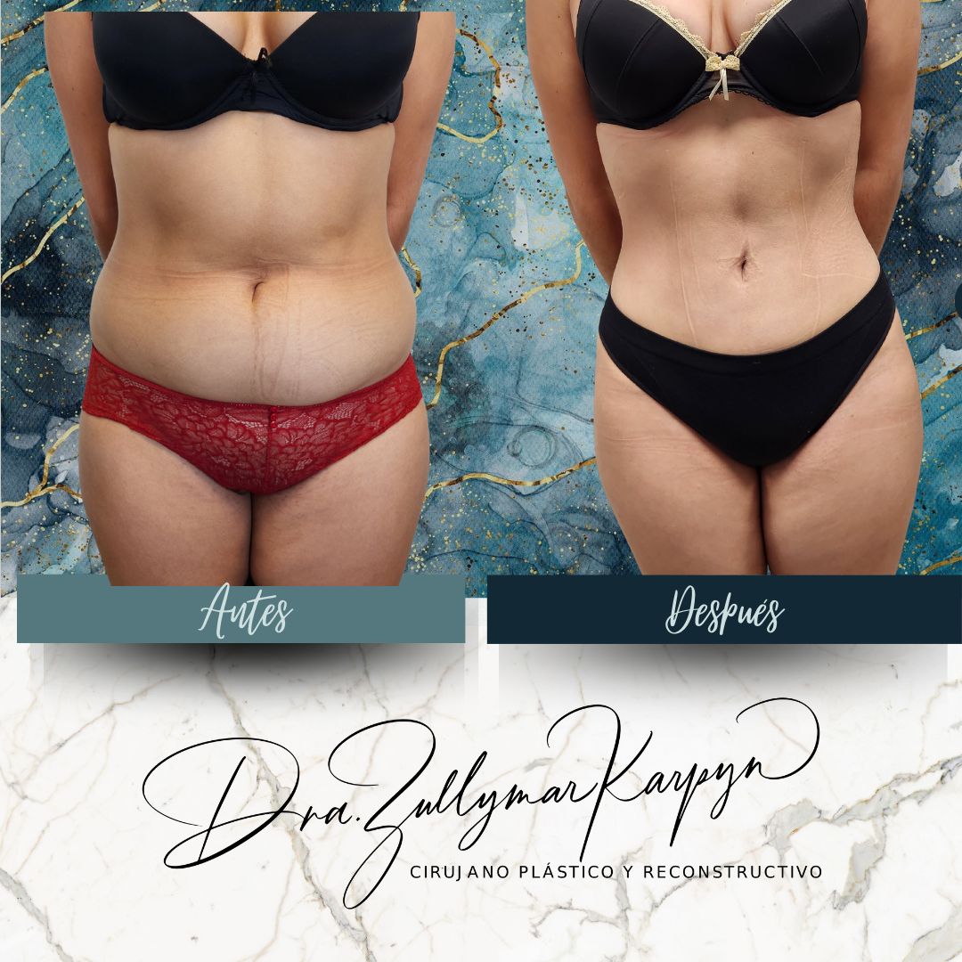 Zullymar Karpyn Brito-9