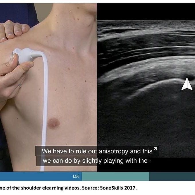 Victor Fontes Pacheco-26