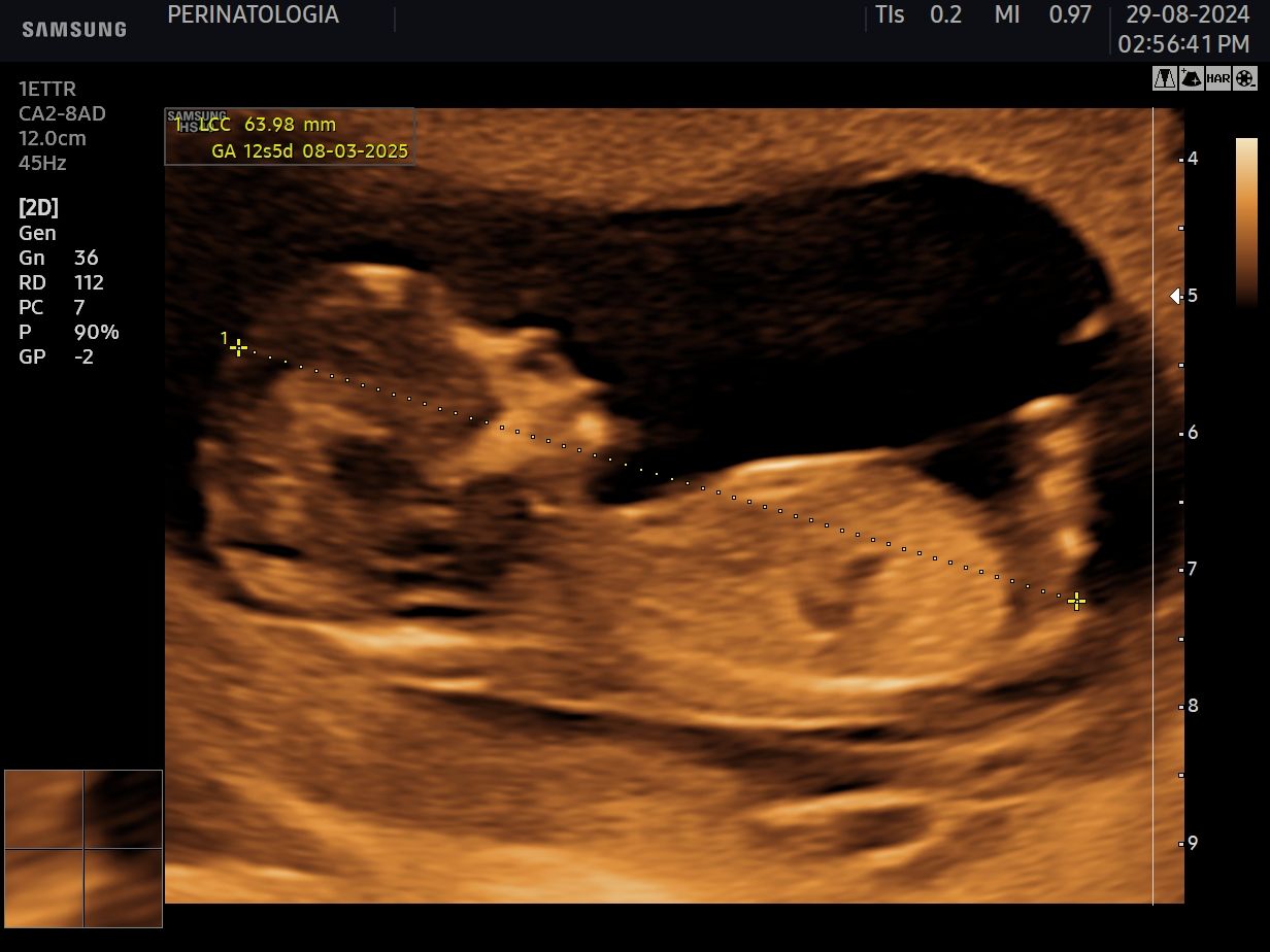 Karina Bastidas Ibarra-3